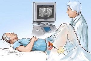 Diagnosis of prostate